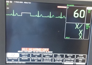 ekg-monitor